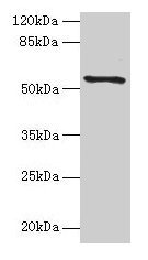 TMEM161A Antibody - Western Blot Positive WB detected in: Rat liver tissue All lanes: TMEM161A antibody at 2.5µg/ml Secondary Goat polyclonal to rabbit IgG at 1/50000 dilution Predicted band size: 54, 42 kDa Observed band size: 42 kDa
