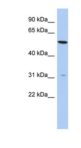 TMEM161B Antibody - TMEM161B antibody Western blot of HepG2 cell lysate. This image was taken for the unconjugated form of this product. Other forms have not been tested.