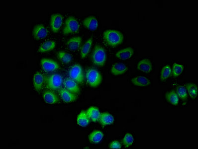 TMEM161B Antibody - Immunofluorescent analysis of A549 cells using TMEM161B Antibody at dilution of 1:100 and Alexa Fluor 488-congugated AffiniPure Goat Anti-Rabbit IgG(H+L)