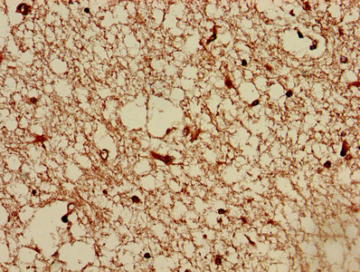 TMEM161B Antibody - Immunohistochemistry of paraffin-embedded human brain tissue using TMEM161B Antibody at dilution of 1:100