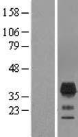 TMEM163 Protein - Western validation with an anti-DDK antibody * L: Control HEK293 lysate R: Over-expression lysate