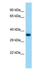 TMEM164 Antibody - TMEM164 antibody Western Blot of Mouse Kidney.  This image was taken for the unconjugated form of this product. Other forms have not been tested.