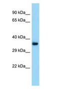 TMEM164 Antibody - TMEM164 antibody Western Blot of Mouse Kidney.  This image was taken for the unconjugated form of this product. Other forms have not been tested.