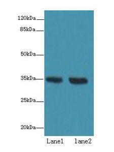 TMEM165 Antibody - Western blot. All lanes: TMEM165 antibody at 8 ug/ml. Lane 1: Jurkat whole cell lysate. Lane 2: HeLa whole cell lysate. Secondary antibody: Goat polyclonal to Rabbit IgG at 1:10000 dilution. Predicted band size: 35 kDa. Observed band size: 35 kDa.