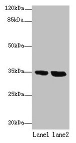 TMEM165 Antibody - Western blot All lanes: TMEM165 antibody at 8µg/ml Lane 1: Jurkat whole cell lysate Lane 2: Hela whole cell lysate Secondary Goat polyclonal to rabbit IgG at 1/10000 dilution Predicted band size: 35, 29 kDa Observed band size: 35 kDa