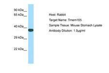 TMEM165 Antibody -  This image was taken for the unconjugated form of this product. Other forms have not been tested.
