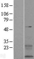 TMEM167B Protein - Western validation with an anti-DDK antibody * L: Control HEK293 lysate R: Over-expression lysate