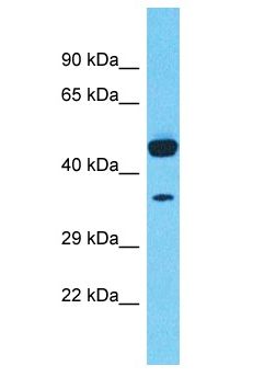 TMEM168 Antibody - TMEM168 antibody Western Blot of Lymph Tumor. Antibody dilution: 1 ug/ml.  This image was taken for the unconjugated form of this product. Other forms have not been tested.
