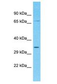 TMEM169 Antibody - TMEM169 antibody Western Blot of Fetal Kidney. Antibody dilution: 1 ug/ml.  This image was taken for the unconjugated form of this product. Other forms have not been tested.