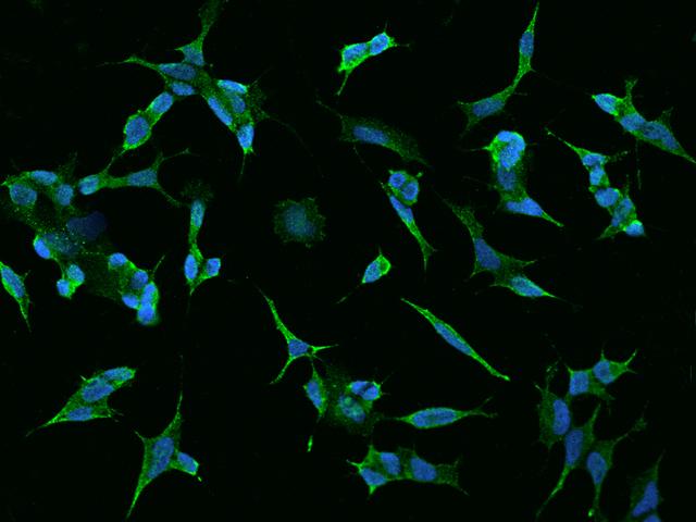 TMEM169 Antibody - Immunofluorescence staining of TMEM169 in SHSY5Y cells. Cells were fixed with 4% PFA, permeabilzed with 0.1% Triton X-100 in PBS, blocked with 10% serum, and incubated with rabbit anti-Human TMEM169 polyclonal antibody (dilution ratio 1:200) at 4°C overnight. Then cells were stained with the Alexa Fluor 488-conjugated Goat Anti-rabbit IgG secondary antibody (green) and counterstained with DAPI (blue). Positive staining was localized to Cytoplasm and cell membrane.