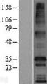 TMEM169 Protein - Western validation with an anti-DDK antibody * L: Control HEK293 lysate R: Over-expression lysate