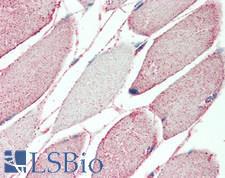 TMEM16B / ANO2 Antibody - Human Skeletal Muscle: Formalin-Fixed, Paraffin-Embedded (FFPE)