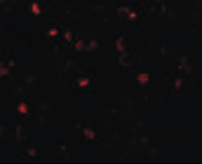 TMEM16B / ANO2 Antibody - Immunofluorescence of TMEM16B in Human Brain cells with TMEM16B antibody at 20 ug/ml.