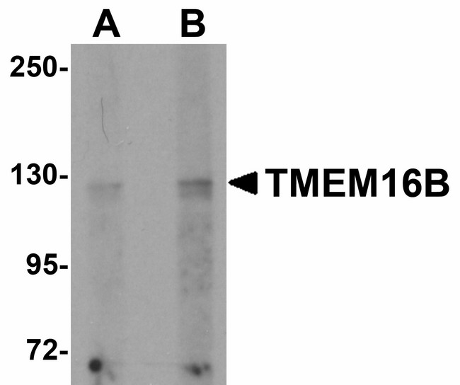 TMEM16B / ANO2 Antibody - Western blot of TMEM16B in rat brain tissue lysate with TMEM16B antibody at (A) 1 and (B) 2 ug/ml.