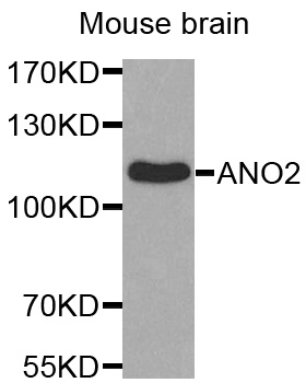 TMEM16B / ANO2 Antibody - Western blot analysis of extracts of Mouse brain cell line, using ANO2 antibody.