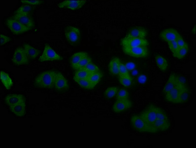 TMEM16B / ANO2 Antibody - Immunofluorescence staining of HepG2 cells at a dilution of 1:200, counter-stained with DAPI. The cells were fixed in 4% formaldehyde, permeabilized using 0.2% Triton X-100 and blocked in 10% normal Goat Serum. The cells were then incubated with the antibody overnight at 4 °C.The secondary antibody was Alexa Fluor 488-congugated AffiniPure Goat Anti-Rabbit IgG (H+L) .