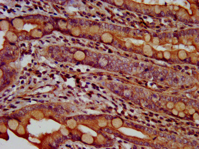 TMEM16B / ANO2 Antibody - Immunohistochemistry image at a dilution of 1:600 and staining in paraffin-embedded human small intestine tissue performed on a Leica BondTM system. After dewaxing and hydration, antigen retrieval was mediated by high pressure in a citrate buffer (pH 6.0) . Section was blocked with 10% normal goat serum 30min at RT. Then primary antibody (1% BSA) was incubated at 4 °C overnight. The primary is detected by a biotinylated secondary antibody and visualized using an HRP conjugated SP system.