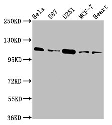 TMEM16B / ANO2 Antibody - Western Blot Positive WB detected in: Hela whole cell lysate, U87 whole cell lysate, U251 whole cell lysate, MCF-7 whole cell lysate, Rat heart tissue All lanes: ANO2 antibody at 3.9µg/ml Secondary Goat polyclonal to rabbit IgG at 1/50000 dilution Predicted band size: 114 kDa Observed band size: 114 kDa