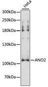 TMEM16B / ANO2 Antibody - Western blot analysis of extracts of HeLa cells, using ANO2 antibody at 1:3000 dilution. The secondary antibody used was an HRP Goat Anti-Rabbit IgG (H+L) at 1:10000 dilution. Lysates were loaded 25ug per lane and 3% nonfat dry milk in TBST was used for blocking. An ECL Kit was used for detection and the exposure time was 20s.