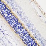 TMEM16B / ANO2 Antibody - Immunohistochemistry of paraffin-embedded Rat retina using ANO2 Polyclonal Antibody at dilution of 1:200 (40x lens).