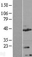TMEM170A Protein - Western validation with an anti-DDK antibody * L: Control HEK293 lysate R: Over-expression lysate