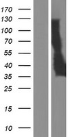 TMEM171 Protein - Western validation with an anti-DDK antibody * L: Control HEK293 lysate R: Over-expression lysate