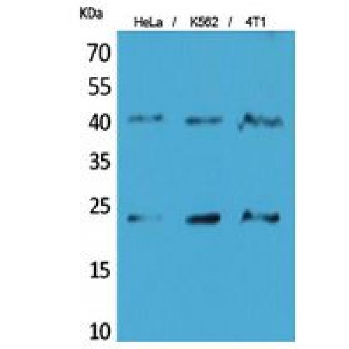 TMEM173 / STING Antibody - Western blot of TMEM173 antibody