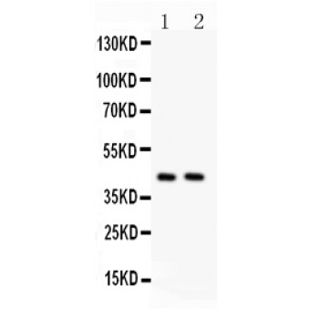 TMEM173 / STING Antibody - TMEM173 antibody Western blot. All lanes: Anti TMEM173 at 0.5 ug/ml. Lane 1: A549 Whole Cell Lysate at 40 ug. Lane 2: HELA Whole Cell Lysate at 40 ug. Predicted band size: 42 kD. Observed band size: 42 kD.