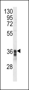 TMEM173 / STING Antibody - Western blot of TM173 Antibody in Jurkat cell line lysates (35 ug/lane). TM173 (arrow) was detected using the purified antibody.