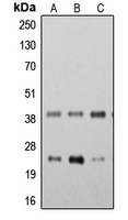 TMEM173 / STING Antibody - Western blot analysis of STING expression in K562 (A); THP1 (B); HeLa (C) whole cell lysates.