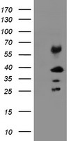 TMEM173 / STING Antibody - HEK293T cells were transfected with the pCMV6-ENTRY control (Left lane) or pCMV6-ENTRY TMEM173 (Right lane) cDNA for 48 hrs and lysed. Equivalent amounts of cell lysates (5 ug per lane) were separated by SDS-PAGE and immunoblotted with anti-TMEM173.