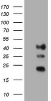 TMEM173 / STING Antibody - HEK293T cells were transfected with the pCMV6-ENTRY control (Left lane) or pCMV6-ENTRY TMEM173 (Right lane) cDNA for 48 hrs and lysed. Equivalent amounts of cell lysates (5 ug per lane) were separated by SDS-PAGE and immunoblotted with anti-TMEM173.