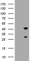 TMEM173 / STING Antibody - HEK293T cells were transfected with the pCMV6-ENTRY control (Left lane) or pCMV6-ENTRY TMEM173 (Right lane) cDNA for 48 hrs and lysed. Equivalent amounts of cell lysates (5 ug per lane) were separated by SDS-PAGE and immunoblotted with anti-TMEM173.