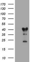 TMEM173 / STING Antibody - HEK293T cells were transfected with the pCMV6-ENTRY control (Left lane) or pCMV6-ENTRY TMEM173 (Right lane) cDNA for 48 hrs and lysed. Equivalent amounts of cell lysates (5 ug per lane) were separated by SDS-PAGE and immunoblotted with anti-TMEM173.