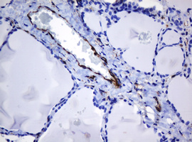 TMEM173 / STING Antibody - IHC of paraffin-embedded Human thyroid tissue using anti-TMEM173 mouse monoclonal antibody. (Heat-induced epitope retrieval by 10mM citric buffer, pH6.0, 120°C for 3min).