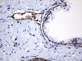 TMEM173 / STING Antibody - IHC of paraffin-embedded Human prostate tissue using anti-TMEM173 mouse monoclonal antibody. (Heat-induced epitope retrieval by 10mM citric buffer, pH6.0, 120°C for 3min).