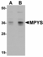TMEM173 / STING Antibody - Western blot of MPYS in A-20 cell lysate with MPYS antibody at (A) 1 and (B) 2 ug/ml. Below: Immunocytochemistry of MPYS in A20 cells with MPYS antibody at 5 ug/ml.