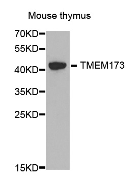 TMEM173 / STING Antibody - Western blot analysis of extracts of various cell line, using TMEM173 antibody.