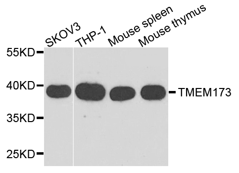 TMEM173 / STING Antibody - Western blot analysis of extract of various cells.