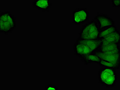 TMEM173 / STING Antibody - Immunofluorescent analysis of MCF-7 cells diluted at 1:100 and Alexa Fluor 488-congugated AffiniPure Goat Anti-Rabbit IgG(H+L)