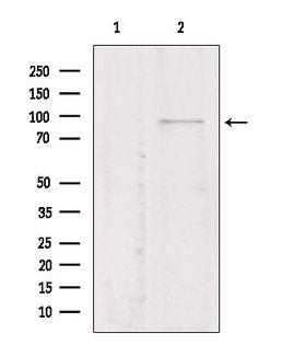 TMEM173 / STING Antibody - Western blot analysis of extracts of mouse myeloma using TMEM173/STING antibody. Lane 1 was treated with the blocking peptide.