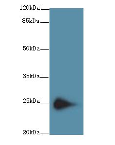TMEM174 Antibody - Western blot. All lanes: TMEM174 antibody at 0.8 ug/ml+ Mouse kidney tissue Goat polyclonal to rabbit at 1:10000 dilution. Predicted band size: 26 kDa. Observed band size: 26 kDa.