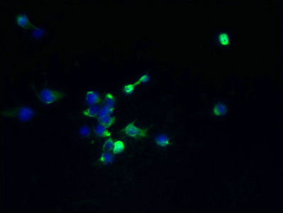 TMEM174 Antibody - Immunofluorescent analysis of 293T cells using TMEM174 Antibody at dilution of 1:100 and Alexa Fluor 488-congugated AffiniPure Goat Anti-Rabbit IgG(H+L)