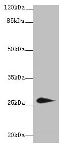 TMEM174 Antibody - Western blot All lanes: TMEM174 antibody at 0.8µg/ml + Mouse kidney tissue Secondary Goat polyclonal to rabbit IgG at 1/10000 dilution Predicted band size: 27, 24 kDa Observed band size: 27 kDa