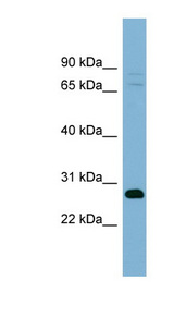 TMEM176A / HCA112 Antibody - TMEM176A antibody Western blot of Fetal Stomach lysate. This image was taken for the unconjugated form of this product. Other forms have not been tested.