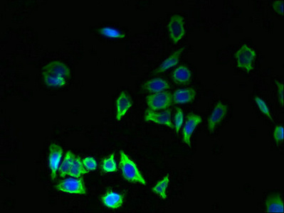 TMEM176B / LR8 Antibody - Immunofluorescent analysis of LO2 cells using TMEM176B Antibody at dilution of 1:100 and Alexa Fluor 488-congugated AffiniPure Goat Anti-Rabbit IgG(H+L)