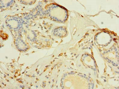 TMEM176B / LR8 Antibody - Immunohistochemistry of paraffin-embedded human breast cancer using TMEM176B Antibody at dilution of 1:100