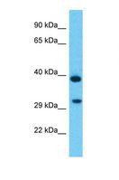 TMEM177 Antibody - Western blot of Human COLO205. TMEM177 antibody dilution 1.0 ug/ml.  This image was taken for the unconjugated form of this product. Other forms have not been tested.