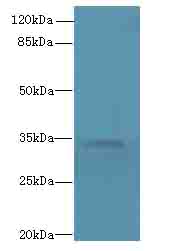 TMEM177 Antibody - Western blot. All lanes: TMEM177 antibody at 5 ug/ml+COLO2w- whole cell lysate Goat polyclonal to rabbit at 1:10000 dilution. Predicted band size: 34 kDa. Observed band size: 34 kDa.