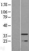 TMEM177 Protein - Western validation with an anti-DDK antibody * L: Control HEK293 lysate R: Over-expression lysate